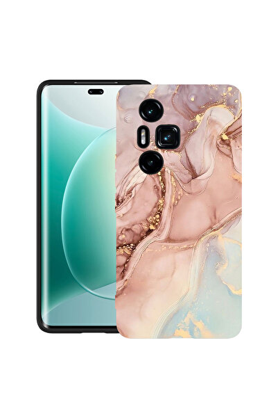 bestcase Carcasă ultra subțire TPU mat pentru Honor 300 Pro / 300 Ultra, roz ...