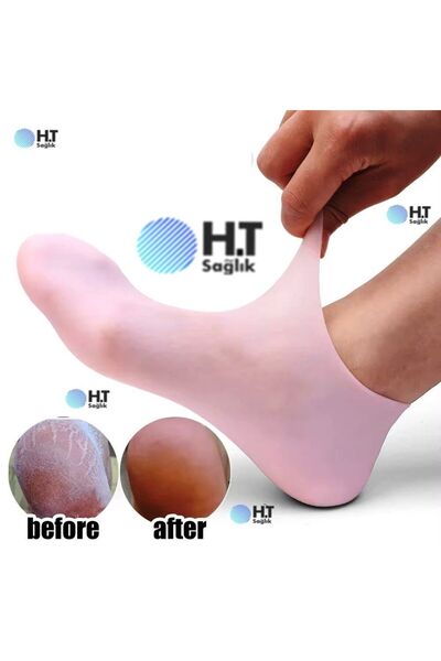 Ht Sağlık Silikon Jel Nemlendirici Ayak Bakım Çorabı - topuk çatlağı nasır