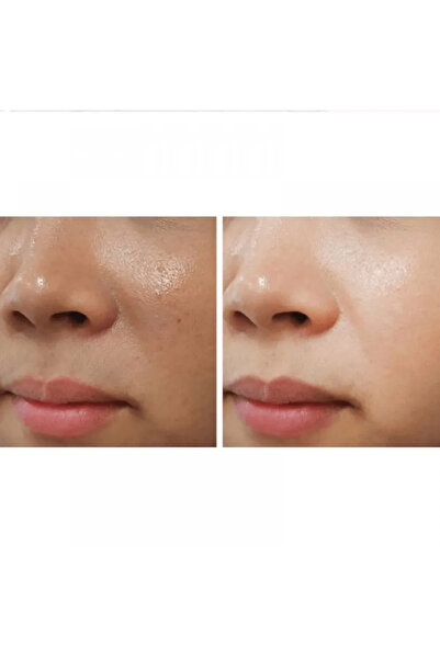 ACM ACM Depiwhite Advanced Cream - 40ml