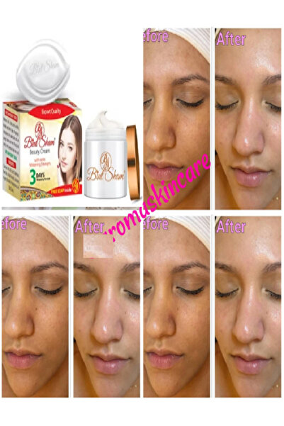 Genel Markalar Yaşlanma Karşıtı, Kremi, Akne Kremi, Çil Kremi, Kızarıklık Kre...