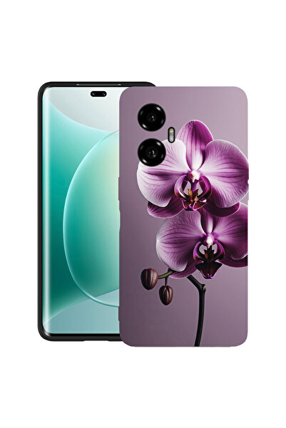 bestcase Ултра тънък TPU матов калъф за Honor 300, цвят Розова орхидея, 20520...