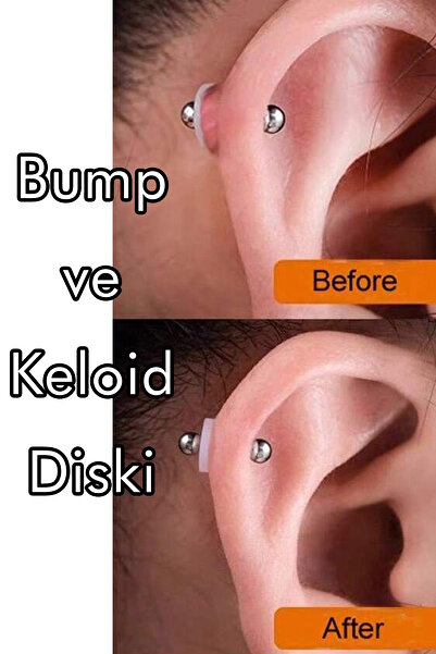 Home PİERCİNG KELOİD BUMP ÖNLEYİCİ SİLİKON DİSK HELİX TRAGUS CHONC 10 ADET
