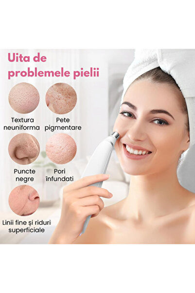 OEMN Dispozitiv cosmetic pentru microdermabraziune, 3 niveluri de intensitate, cu functie de curatare a t