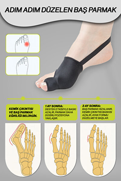Exland Hallux Valgus Baş Parmak Düzeltici Çorap – Çift Silikon Destek + Kaymaz Topuk Lastiği