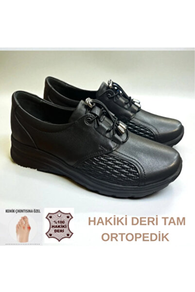 Cozi company أحذية طبية من الجلد الطبيعي ذات نعل غير قابل للانزلاق لعلاج تشوه إصبع القدم الكبير