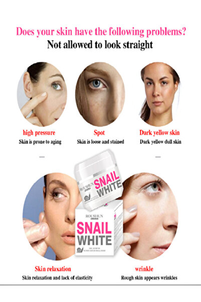 seven gırl snail Snail White Güzellik Kremi Leke,,Akne,Güneş Yanıkları,Doğum ...