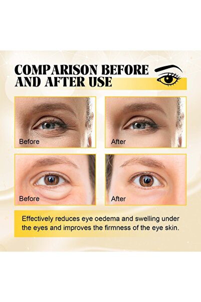 Hoygi 60 قطعة من أقنعة الكولاجين للعين، لاصقات تحت العين لعلاج الهالات السوداء وعلامات التقدم في السن