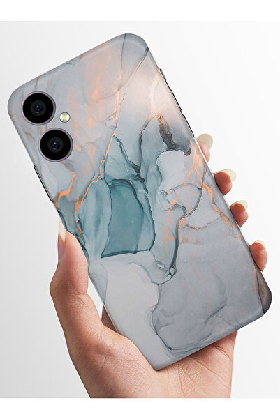 omix X3 Kılıf Kamera Korumalı Baskılı Silikon Kapak - stok2