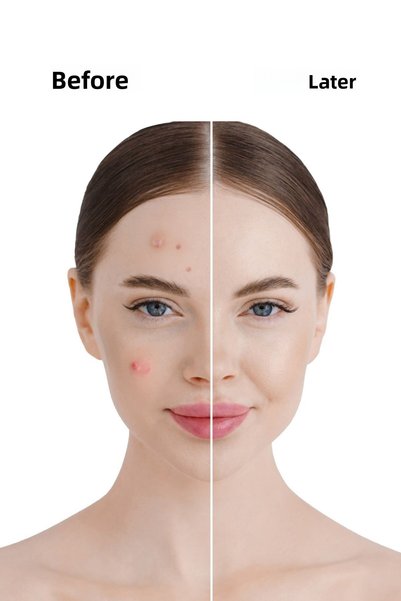 THE FINE ORGANICS مستخلص التوت البري، والنياسيناميد، والزنك، سيروم مضاد للبقع الداكنة ومفتح للبشرة، 30 مل