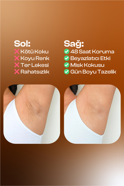 misk Roll-On Deodorant & Beyazlatıcı Natural İçerik | Unisex