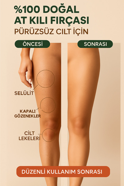 Dermotik %100 Doğal At Kılı Fırçası – Selülit ve Çatlak Karşıtı & Kuru Fırçalama, Cilt Sıkılaştırıcı Fırça