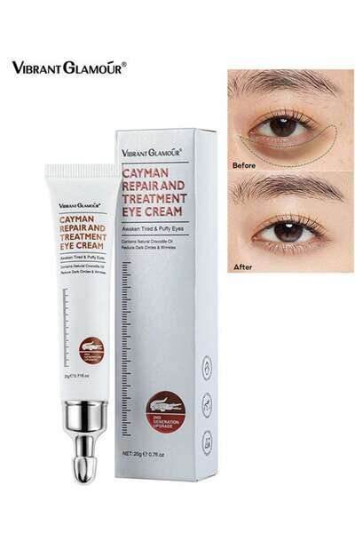 Vibrant Glamour كريم كايمان لإصلاح وعلاج العيون 20 جرام
