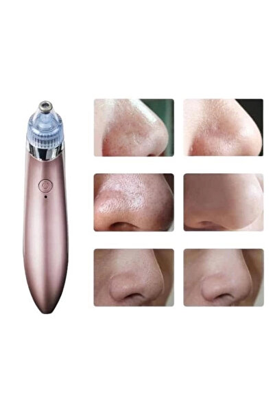 Glowify Store جهاز إزالة الرؤوس السوداء من بوجز