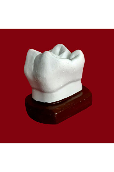 OEM Decoratiune dinte din ipsos cu soclu