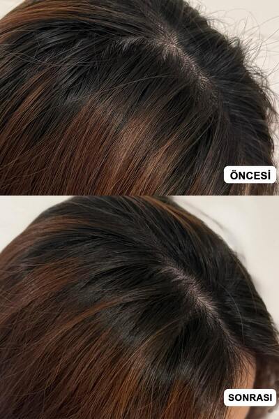 ViveLab Revi Solution Anti Hair Loss Scalp Shampoo/Saç Dökülme Karşıtı ve Güçlendirme Şampuan 300ml