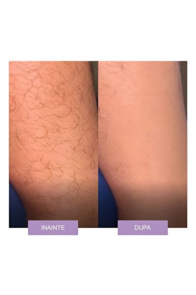 NEO Epilator cu Cristale, pentru Epilarea de Lunga Durata, Mov,