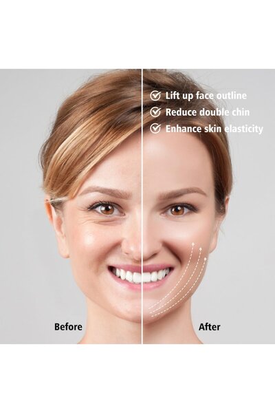 OEM Aparat de lifting facial, masaj facial, 3 niveluri de intensitate: masaj facial cu microcurent EMS pentru V-Sh