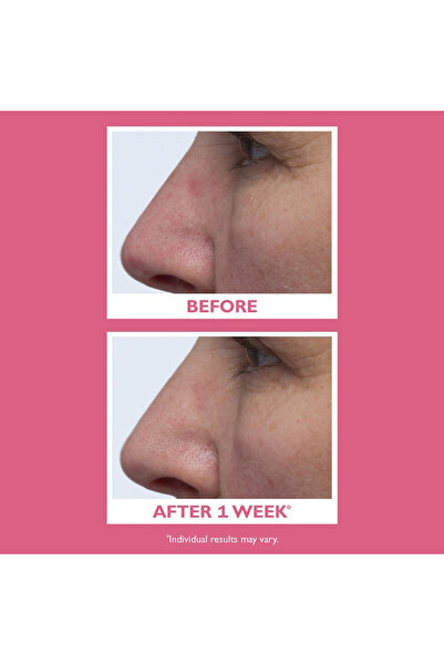 PETER THOMAS ROTH Anti-aging cream Vital-E Microbiome Age Defense Cream, 50 Ml