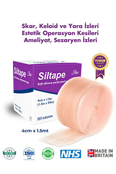 Advancis Medical UK Siltape Soft Silikon Bant - Yanık Sezaryen Dikiş Izi Keloid Ameliyat Izi Giderici 4cmx1,5mt