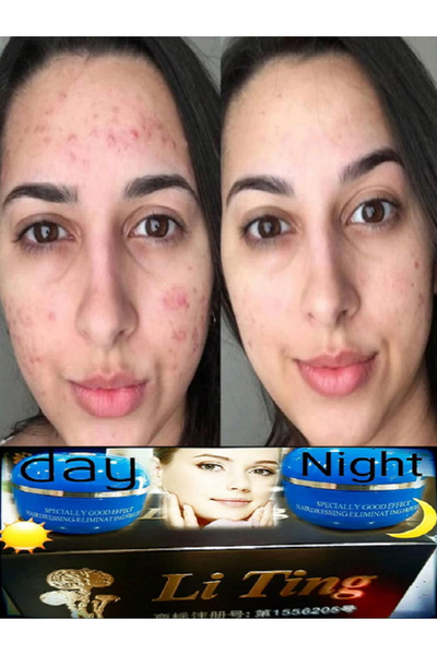 Li Ting Beauty Arap Makyajı Orjinal Çin Kremi Kore Kozmetik Gece Ve Gündüz Kr...