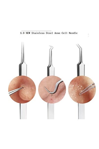 NEO ™ Set of Extraction Tweezers for Blackheads and Acne, Stainless Steel, Storage Case (Set of 6)