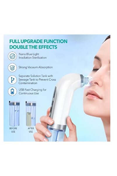 BeSmart Blackhead Remover Pore Cleansing Device, 20 x 7.5 x 5 cm, Multicolor