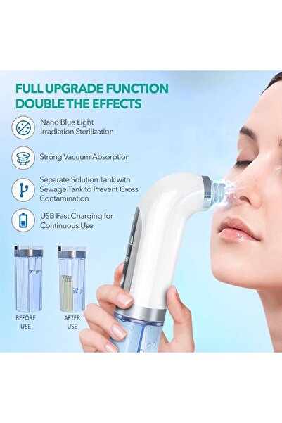 ZOLANA Blackhead Remover and Pore Cleanser Device, 20x7.5x5 cm, Multicolor