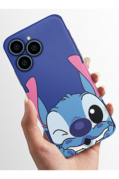 omix X6 Uyumlu Kılıf Kamera Korumalı Baskılı Silikon Kapak - stitch