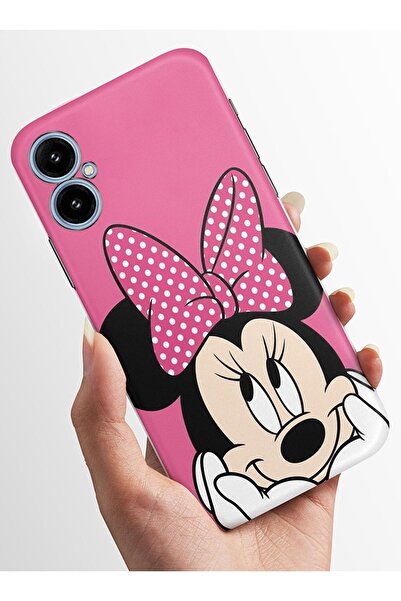 omix X5 Kılıfı HD Kalite Baskılı Parlak Silikon Kapak - Minymouse4