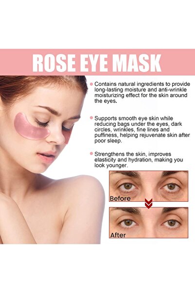 Generic Rose Eye Mask (30 Pairs, Pink) - Reduce Dark Circles, Puffy Eyes, Undereye Bags, Wrinkles, Improve a
