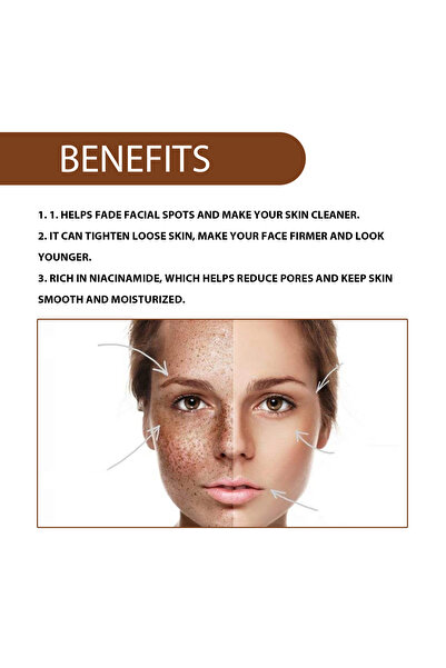 Hoygi Anti Freckle Serum