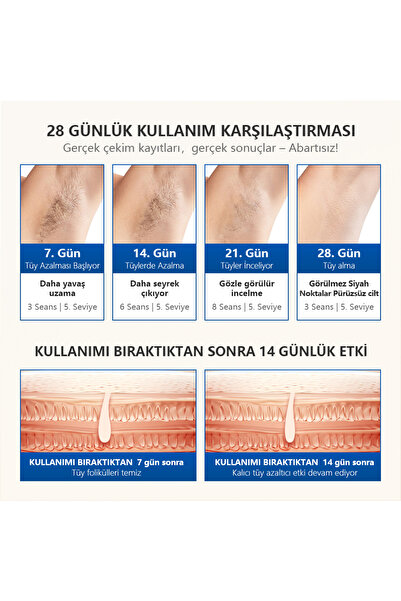 Takma Takma T16B-BKFASR-A1 - Mlay T16 Epilasyon Cİhazı 4 Başlıklı TÜm vücut, Yüz, Bikini, Yaşlılık Karşıtı