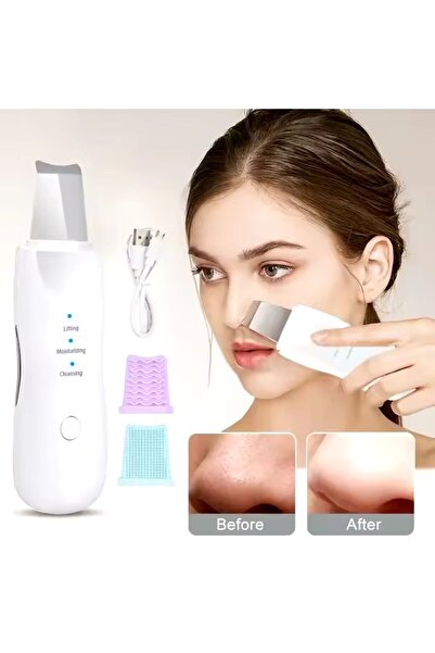 OEM Curatator Facial pentru Piele cu Ultrasunete, Scrubber, Aparat Exfoliere, Puncte Negre, Pori, Acnee