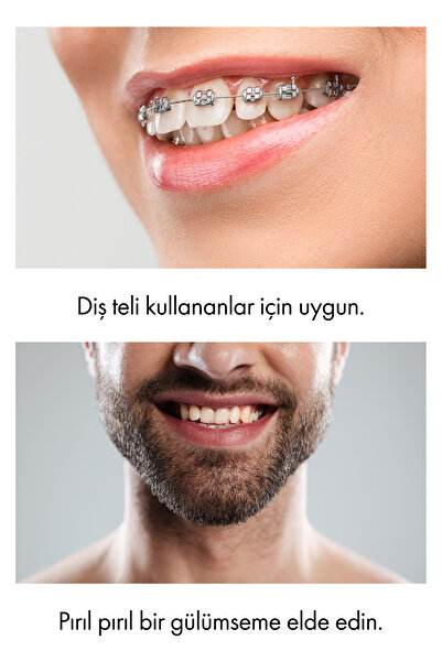 Whirtz Su Püskürtmeli Ağız Duşu – 300ml, Şarjlı, Taşınabilir