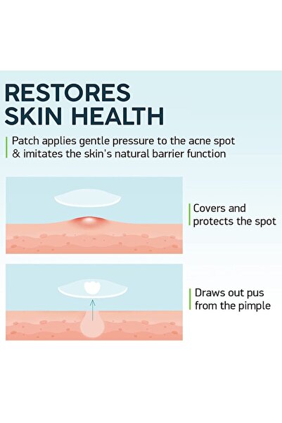 Hero Hydrocolloid Anti-Acne Patches for Whiteheads Treatment, 36 pcs