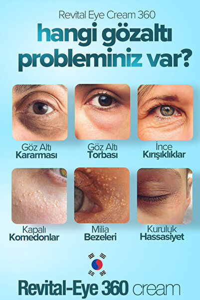 Acabella Göz Altı Torbaları ve Morluk Karşıtı için Krem 50 ml