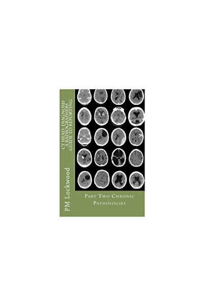 Mcgraw Hill Book Co CT Head: Diagnosis a Radiographers Guide to Reporting Par...