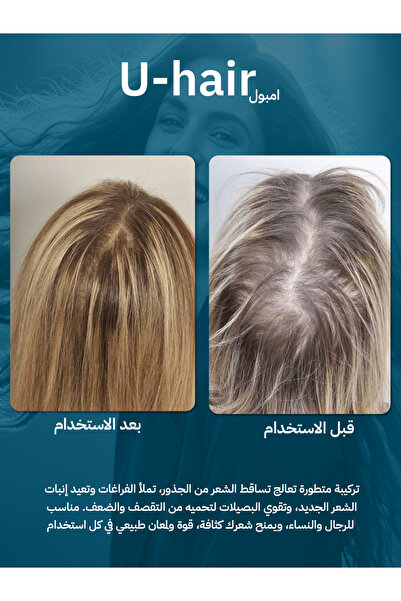 U hair يو هير امبول Ampoule | أفضل علاج لتساقط الشعر وتكثيف الشعر من الجذور