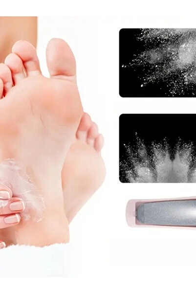 NaturalCharm Elektrikli Ayak Törpüsü – USB Şarjlı, Topuk ve Nasır Temizleyici, Profesyonel Ayak Bakım Cihazı