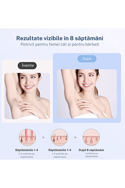 eGROW IPL epilator eGROW® PRO SOFT SKIN, 9 Steps, 999,999 pulses, face, body, armpit, groin, White