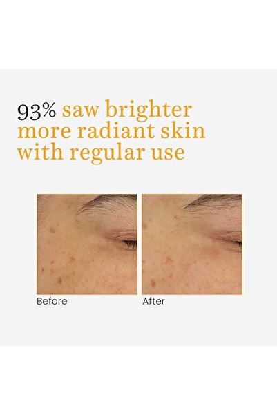 O3+ Vitaminc C & Turmeric Glow Gel Cream 50g