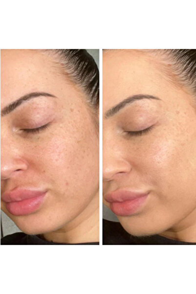 SİNOZ Repair Set 2 in 1 – Pure Cica Tiger Grass Tone Equalizing Cream & Pure Cica Cream