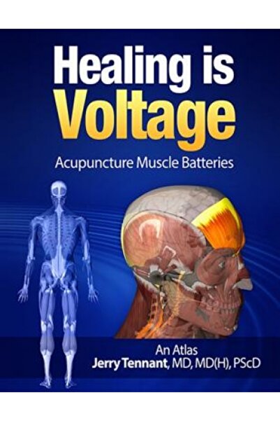 AuthorHouse Healing Is Voltage: Acupuncture Muscle Batteries