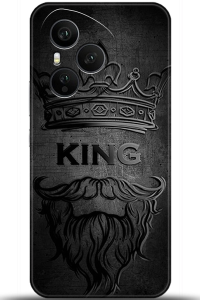 Noprin Honor 400 Pro Case Hd Printed Case - a Pair of Eyes 5456