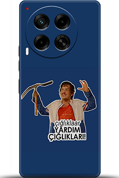 TECNO Camon 30 Kılıf HD Baskılı Kılıf -uyumlu