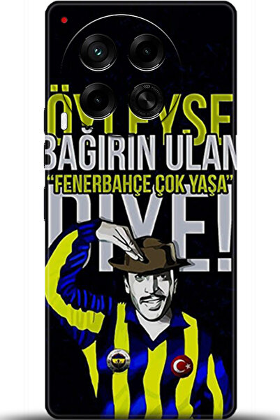 TECNO Camon 30 Kılıf HD Baskılı Kılıf - Keep Following 5051