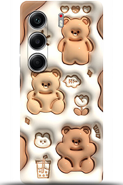 TECNO Camon 40 Pro 5G Kılıf HD Baskılı Kılıf - Keep Following 5047