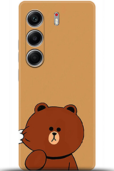 TECNO Camon 40 Pro 5G Kılıf HD Baskılı Kılıf - Keep Following 5417