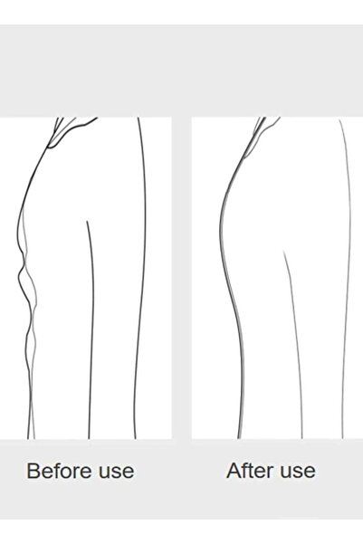 VEYA Invisible Clothes Tighteners 36 Piece Set