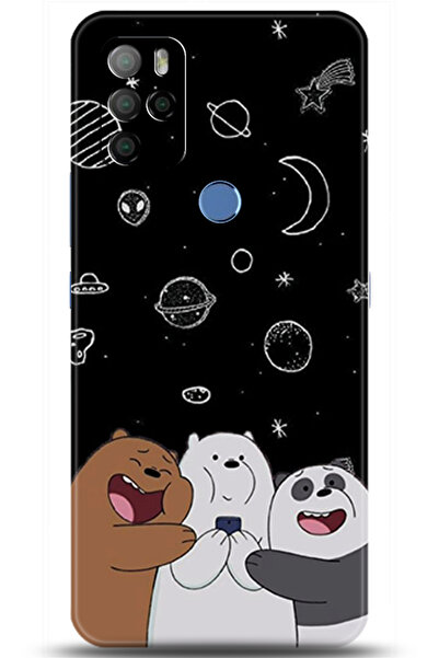 omix X300 Kılıf HD Baskılı Kılıf - A Pair of Eyes 5909